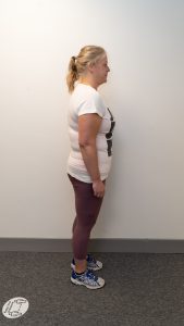 A women standing side on before losing weight